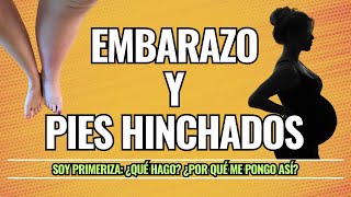 Pies hinchados en el embarazo 🤰🏻 Remedios naturales recomendados por mi doctor [upl. by Blakely]