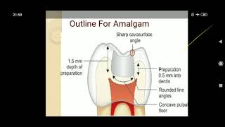 7 pediatric restorative dentistry part ll [upl. by Ethbun124]