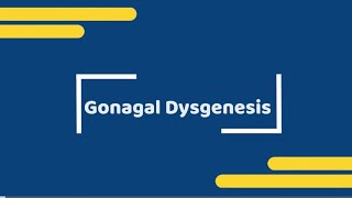 gonadal dysgenesis [upl. by Olly]