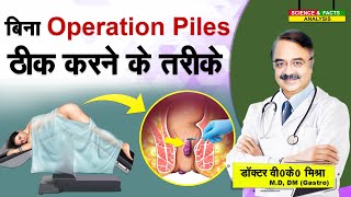 बिना Operation Piles ठीक करने के तरीके  CAN PILES BE CURED WITHOUT SURGERY [upl. by Ttevi]