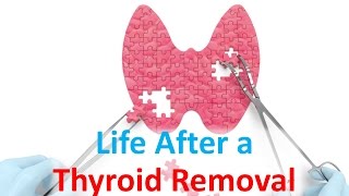 Life After a Thyroid Removal [upl. by Eicirtap684]