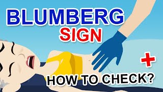 BLUMBERG SIGN [upl. by Kahn258]