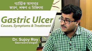 গ্যাস্ট্রিক আলসারের কারণ লক্ষণ ও চিকিৎসা  Gastric Ulcer causes Symptoms amp Treatment [upl. by Bara]