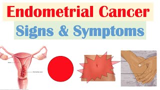 Endometrial Cancer Signs amp Symptoms amp Why They Occur [upl. by Zena588]