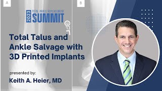 Total Talus and Ankle Salvage with 3D Printed Implants  Keith A Heier MD [upl. by Hazaki]