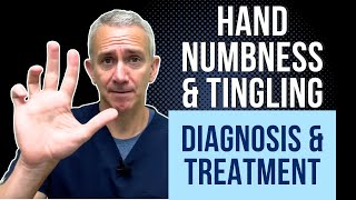 Hand Numbness amp Tingling Diagnosis amp Treatment [upl. by Nylasej316]