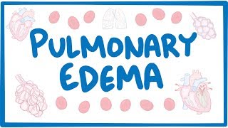 Pulmonary Edema  causes symptoms diagnosis treatment pathology [upl. by Demp996]