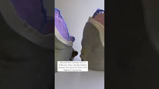 3D models to help prepare surgeons for conjoined twins separation  Watch the connected documentary [upl. by Htir834]