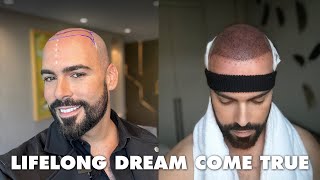 My Emotional Hair Transplant Journey in Istanbul Turkey with Hairneva [upl. by Criswell]