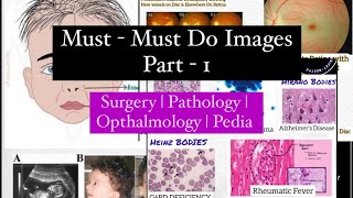 Most important Images Part 1 Neetpg  Inicet  Fmge  MisMedicine [upl. by Barnie981]