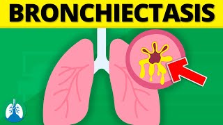 Bronchiectasis Medical Definition  Quick Explainer Video [upl. by Barncard]