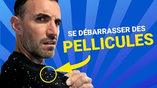 Comment se débarrasser efficacement des Pellicules [upl. by Lomasi]