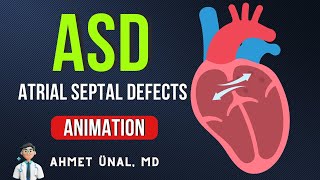 ❤ IS PFO A TYPE OF ASD  🎬 ATRIAL SEPTAL DEFECTS ASD ANIMATION [upl. by Peale]