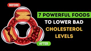 7 Powerful foods to lower bad cholesterol [upl. by Lincoln]