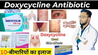 Doxycycline  एंटीबायोटिक  Medicine  Treatment  Antibiotics  doxycycline medicine Used [upl. by Meadow]