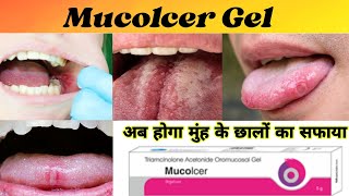 Mucolcer Gel  Mucolcer Gel uses  Mucolcer in hindi [upl. by Acyssej]