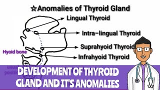 Development of Thyroid Gland and Anomalies of Thyroid gland [upl. by Latrice]