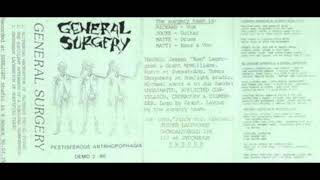 General Surgery  Pestiferous Anthropophagia Demo [upl. by Ruscher521]