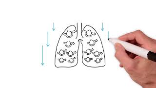 Everything you need to know about the ventilation perfusion ratio [upl. by Boni]