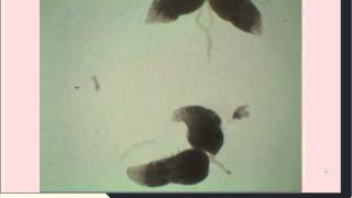 Drosophila Ovarian Dissection for Immunohistochemistry [upl. by Phillip]