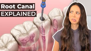 What Is A Root Canal amp Should You Get One [upl. by Sartin]