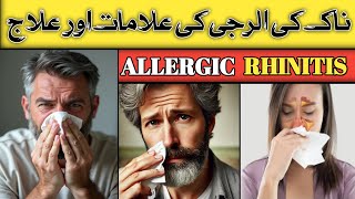 ALLERGIC Rhinitis And Its Treatment  Naak Ki Allergy Ka Ilaj  DrKashif Bilal [upl. by Dewar387]