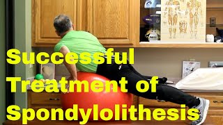 Successful Spondylolisthesis Treatment Without SurgeryLive Active amp PainFree [upl. by Kentiga812]