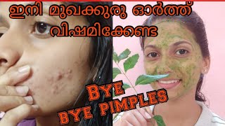 How to Remove Pimples at home My Journey Neem face pack for pimplesamp Dark spots [upl. by Aviv]