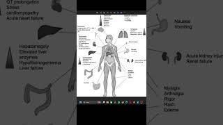 Cytokine Release Syndrome meded oncology criticalcare emergencymedicine medicalschool [upl. by Maller]