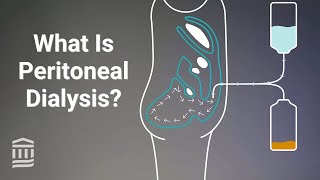 Peritoneal Dialysis At Home Treatment for Kidney Failure  Mass General Brigham [upl. by Hgielrak]