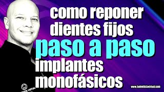 DIENTES NUEVOS en 72 HORAS con IMPLANTES MONOFÁSICOS PROCESO PASO a PASO HOY ES LA MEJOR OPCIÓN [upl. by Tsirc]