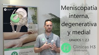 🚶 Meniscopatía interna  meniscopatía medial y degenerativa✅ Fisioterapia para meniscopatía [upl. by Obadias]