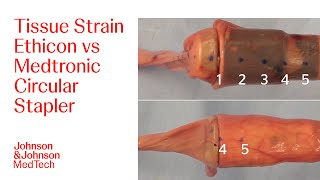 Comparison of Bunching During Device Closing  JampJ MedTech [upl. by Niknar369]