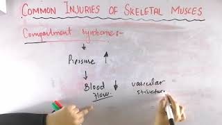 Compartment syndrome  Common injuries of skeletal muscle  Biomechanics of skeletal muscle [upl. by Nele184]