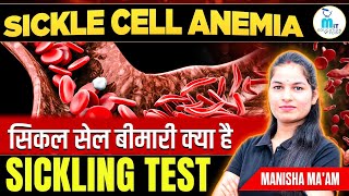 Sickle cell Anemia in hindi  Sickle cell test  Hematology Lecture  MLT Education Point [upl. by Lihp]