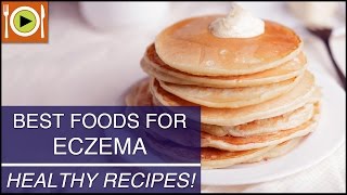 Best Foods for Eczema  Healthy Recipes [upl. by Najram406]