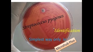 Streptococcus pyogenes identification [upl. by Ysdnyl]