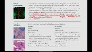 Listeria Monocytogenes Nocardia vs Actinomyces  Microbiology  13  First Aid USMLE in UrduHindi [upl. by Gayle]