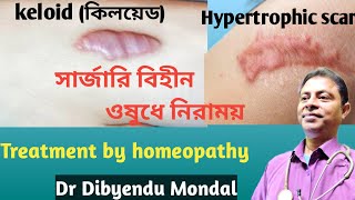 Keloid and Hypertrophic Scar Treatment কিলয়েড কি এবং চিকিৎসাdiptihealth4010 [upl. by Davina757]