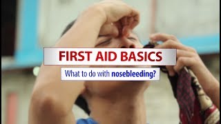 Basic first aid treatment for nosebleeds [upl. by Toscano]