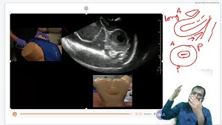 Lecture 2  Ultrasound techniques Demonstration and Anatomy of female Pelvis  By Dr S Moinuddin [upl. by Yrehc463]