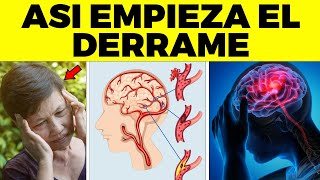 Así Empieza El Derrame Cerebral En Una Mujer  Signos Y Síntomas de Derrame Que Debes Conocer [upl. by Nnahteb]