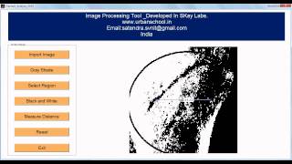 Image Processing Matlab GUI Bone Fracture Analysis [upl. by Rafferty]