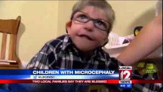 Medical Edge Children with Microcephaly [upl. by Naujid3]