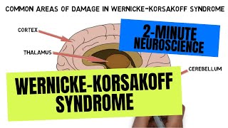 2Minute Neuroscience WernickeKorsakoff Syndrome [upl. by Cotterell]