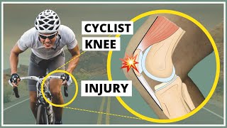 Prepatellar fascia injury also known as Cyclists knee explanation diagnosis and treatment [upl. by Stephannie]