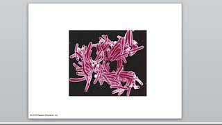 10 3 mycoplasmas and mycobacteria [upl. by Immaj]