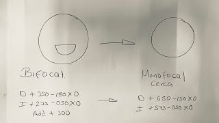 Conversión de bifocal a monofocal [upl. by Roumell]