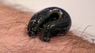 How Leeches are used in Modern Surgery  Earth Science [upl. by Swetiana]