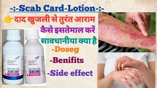 Scab card lotion use in hindi दाद खुजली को जड़ से खत्म करे medicine medical raj pharmacy use [upl. by Yelreveb]